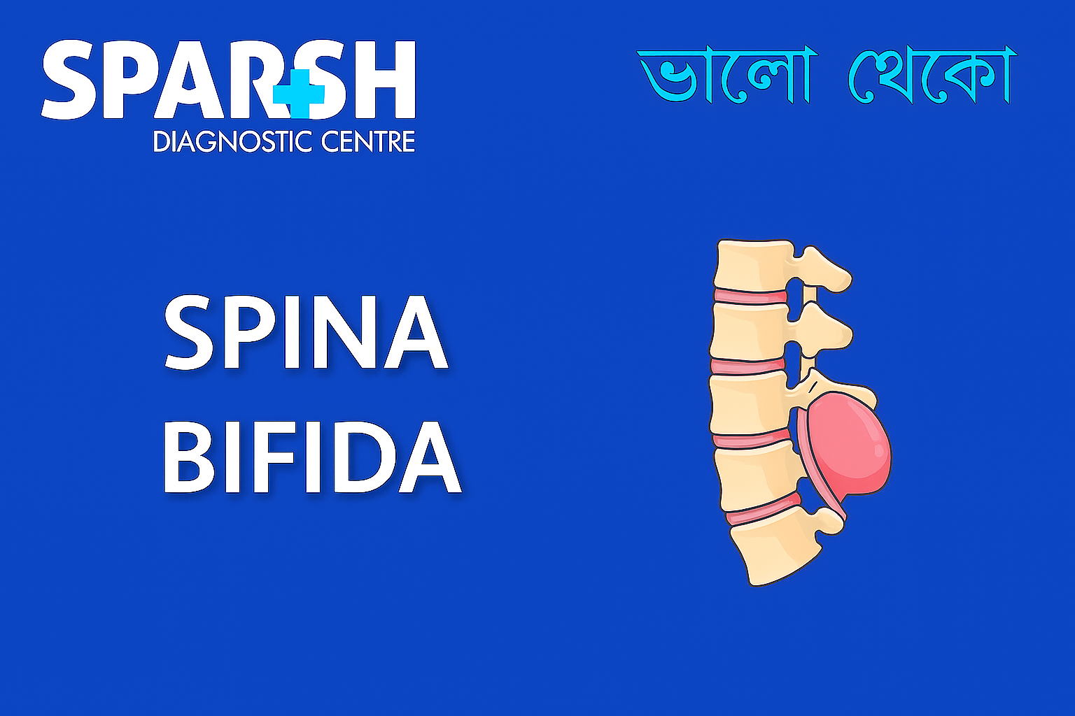 Spina Bifida
