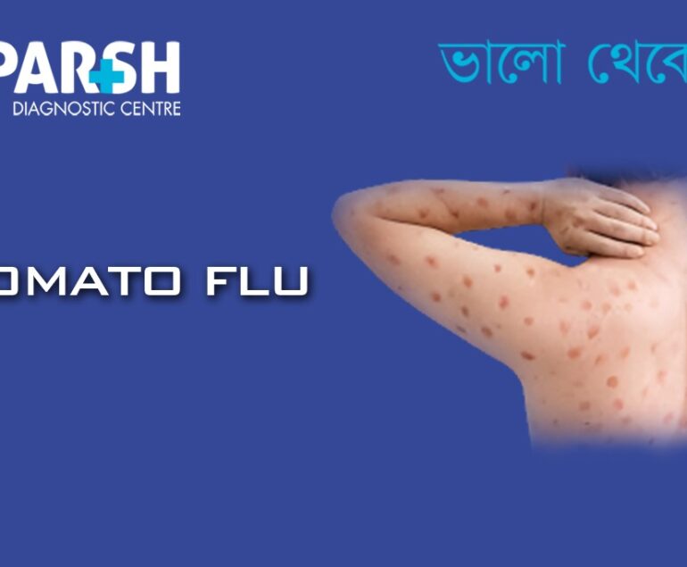 Tomato Flu