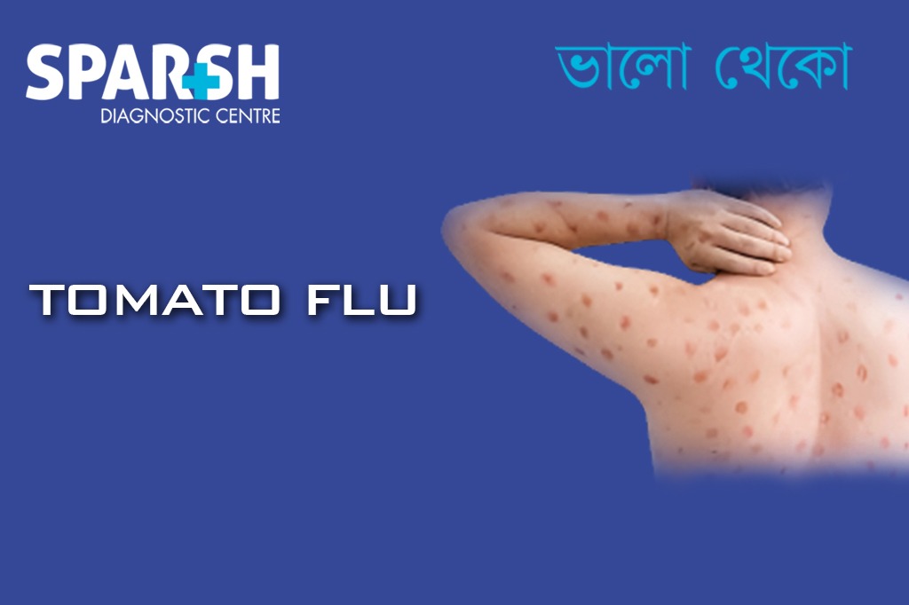 Tomato Flu