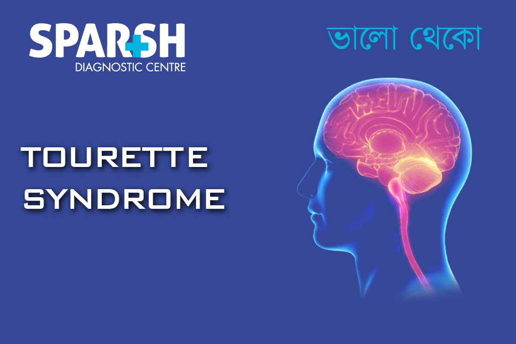 Tourette Syndrome CP
