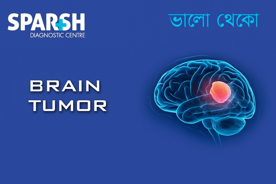 Brain Tumor