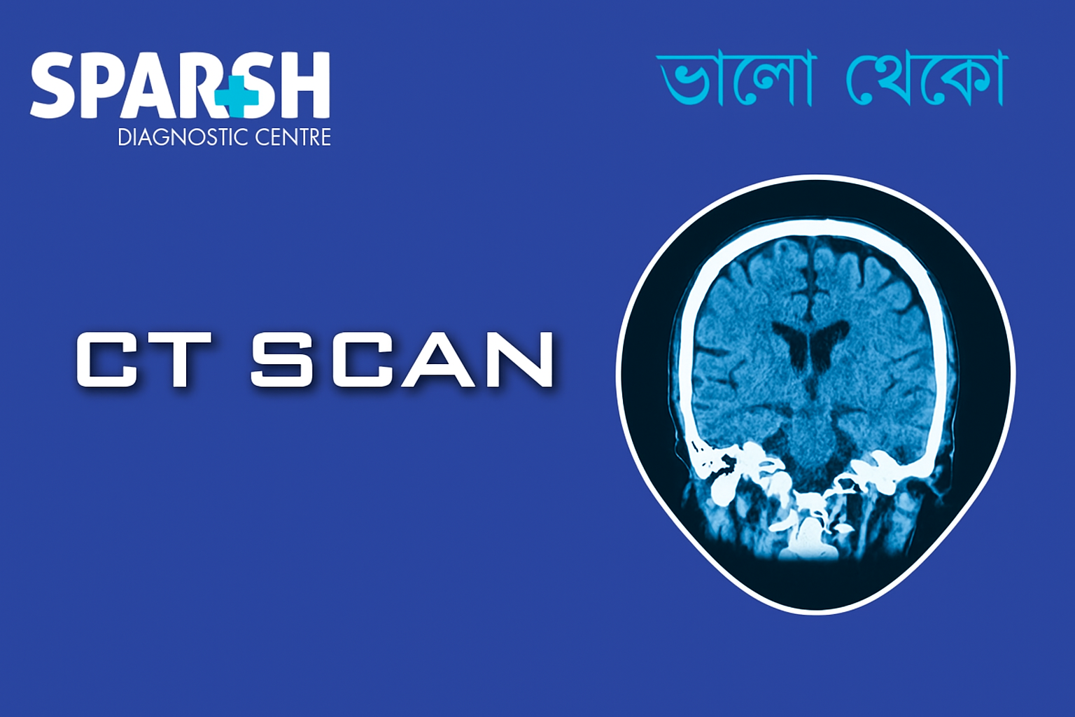 CT Scan