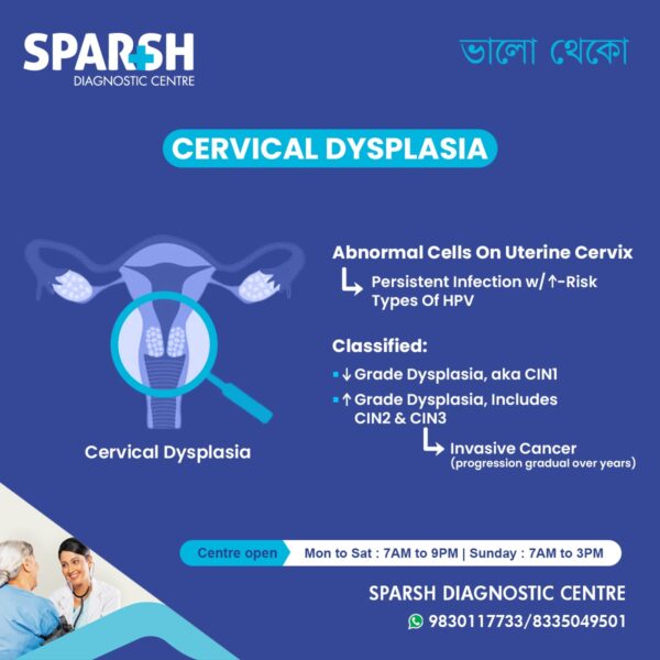 Cervical Dysplasia Causes Symptoms Diagnosis And Treatment Sparsh 