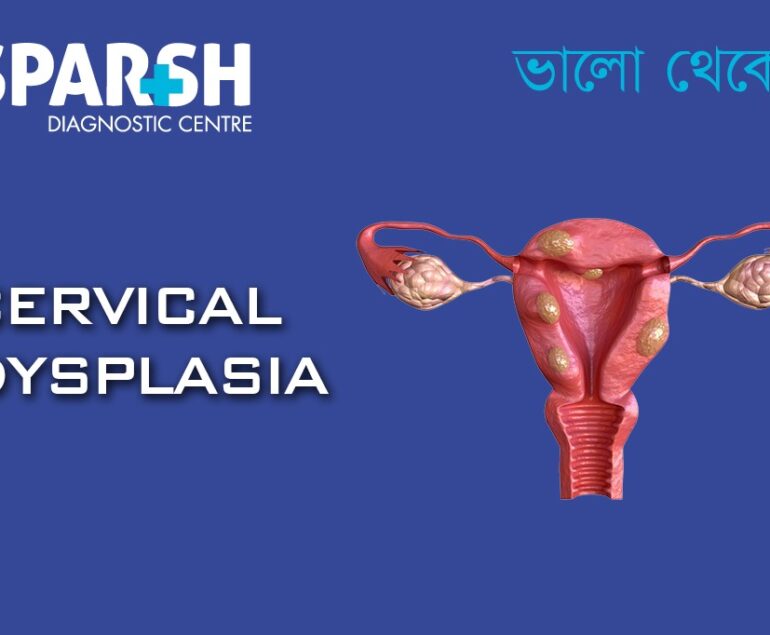 Cervical Dysplasia