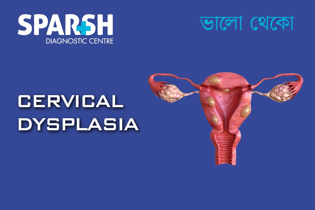 Cervical Dysplasia