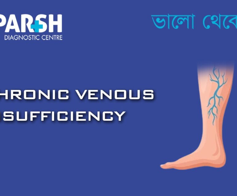 Chronic Venous Insufficiency