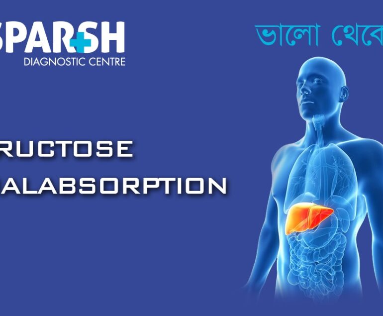 Fructose Malabsorption