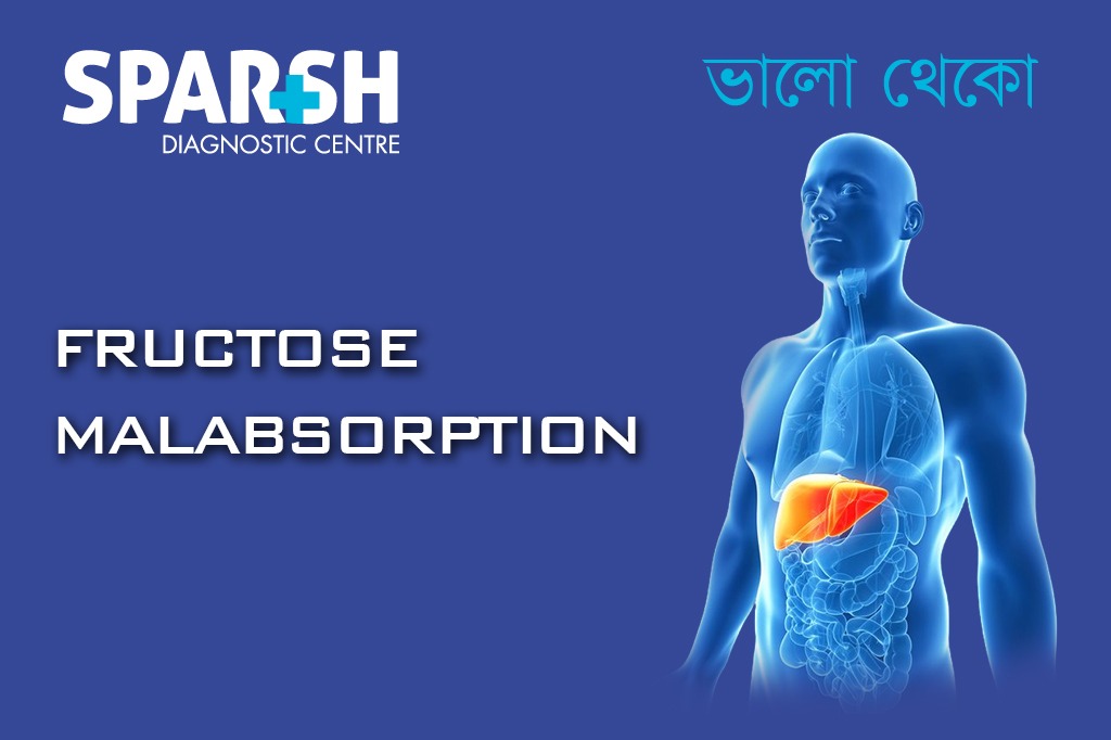 Fructose Malabsorption