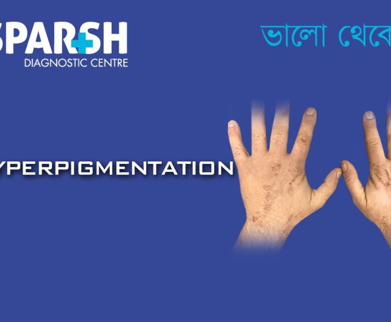 Hyperpigmentation. Blood testing service.