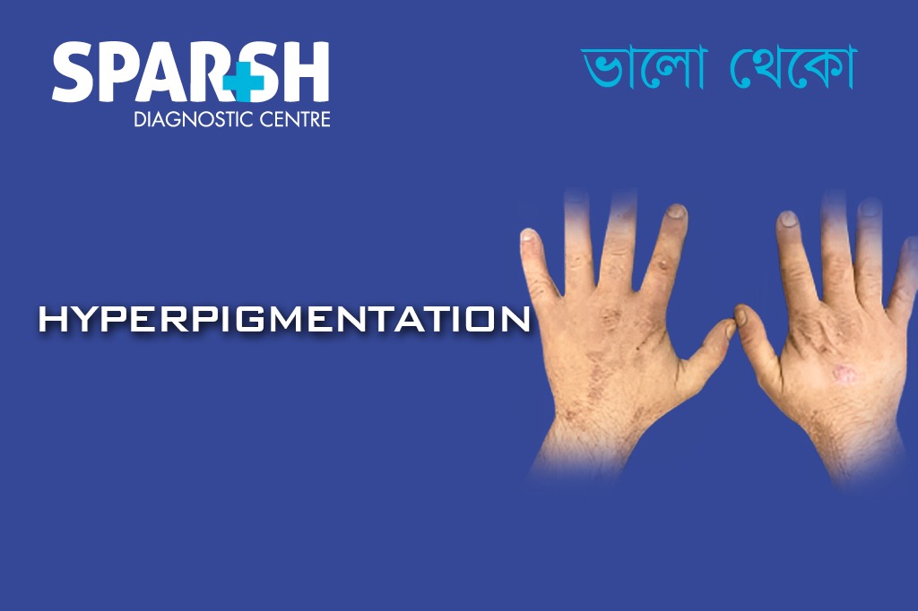 Hyperpigmentation. Blood testing service.