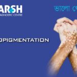 Hypopigmentation. Blood testing service.