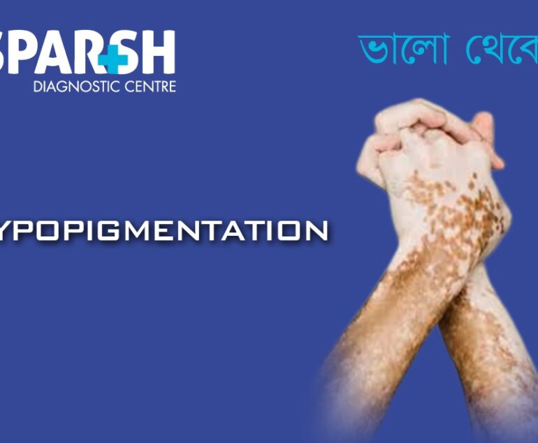 Hypopigmentation. Blood testing service.