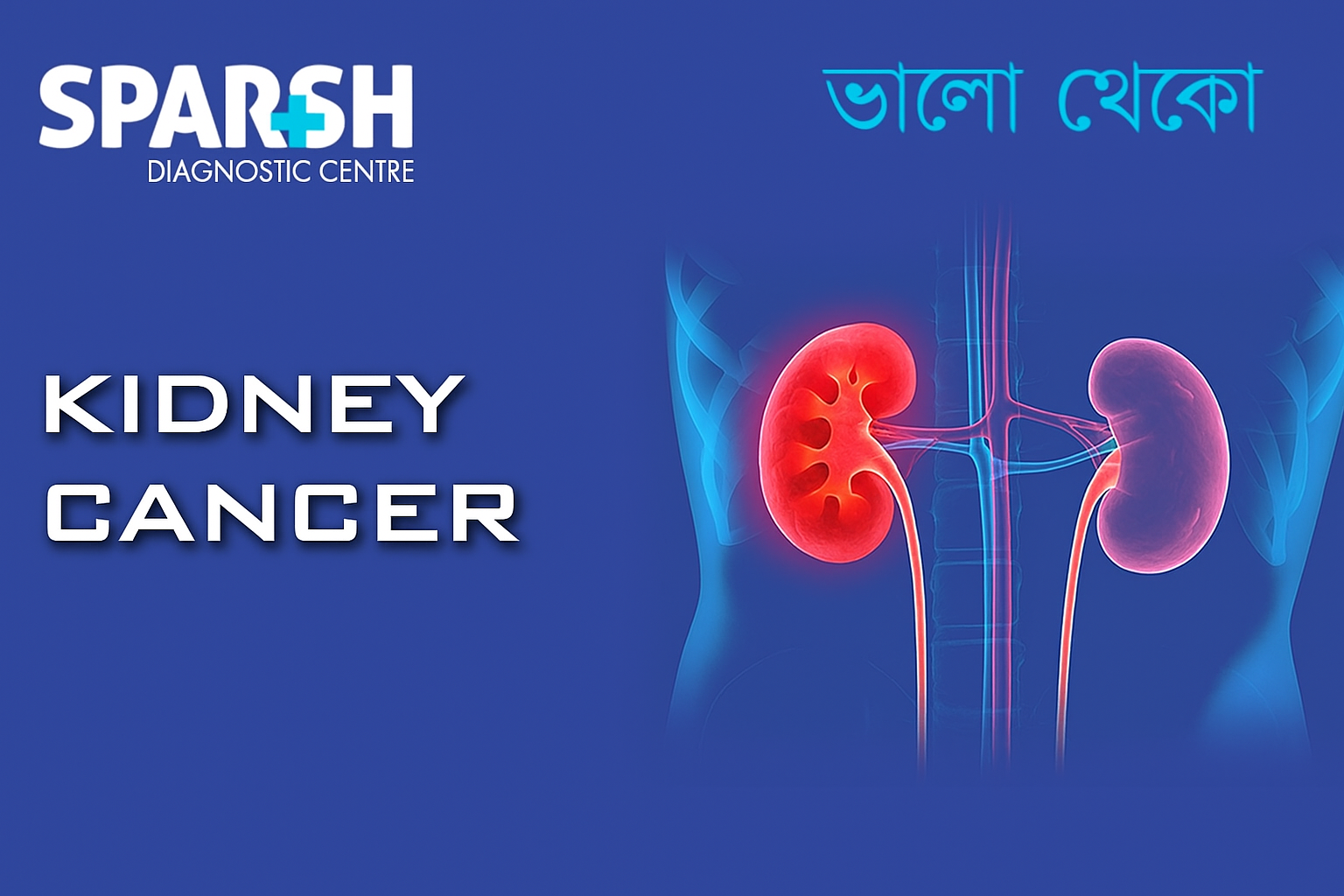 Kidney Cancer