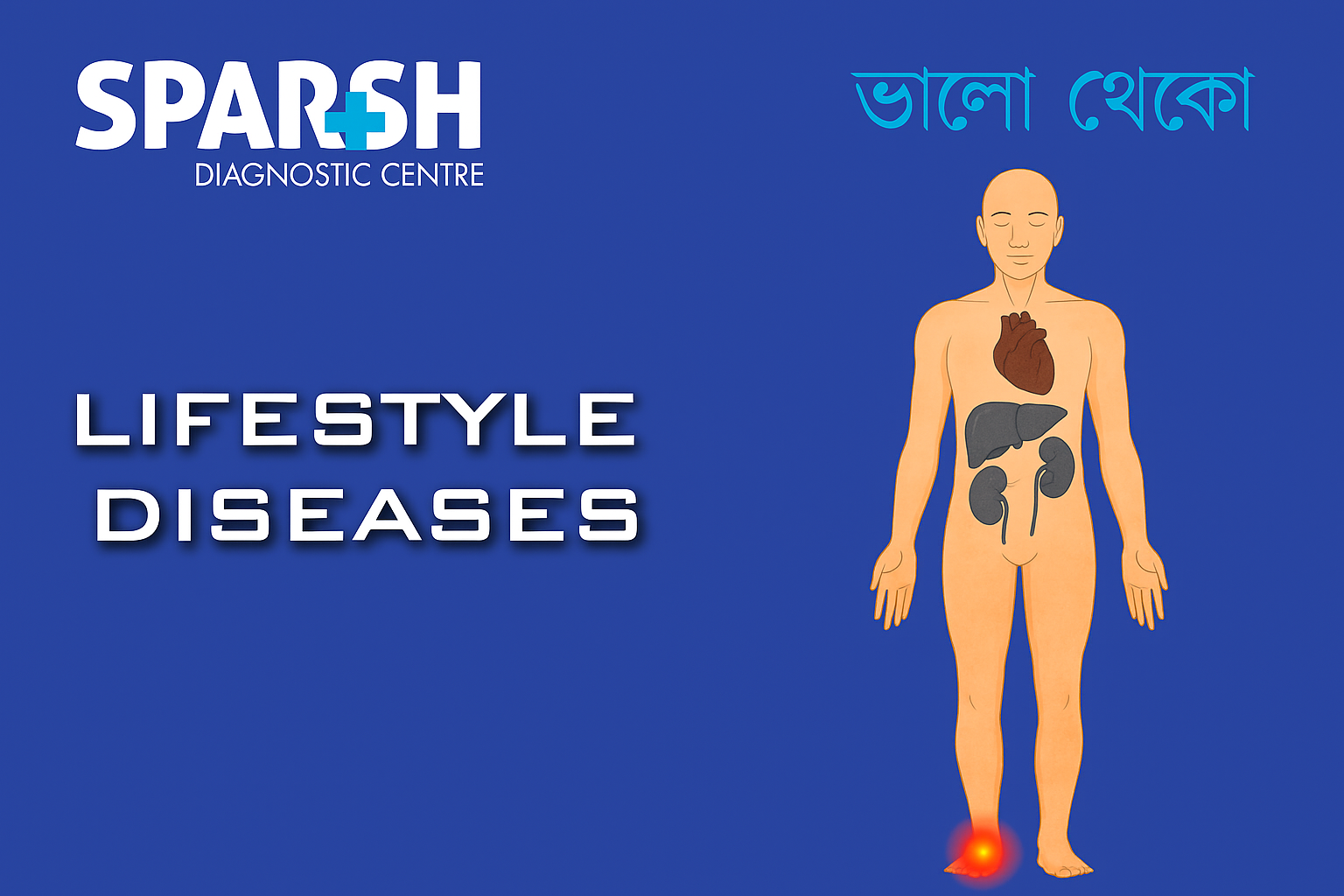 Lifestyle Diseases