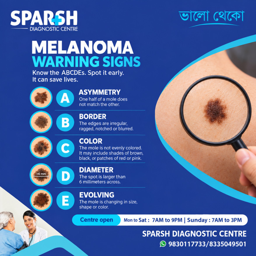 Melanoma