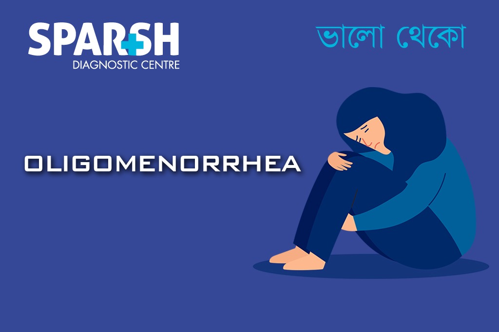 Oligomenorrhea