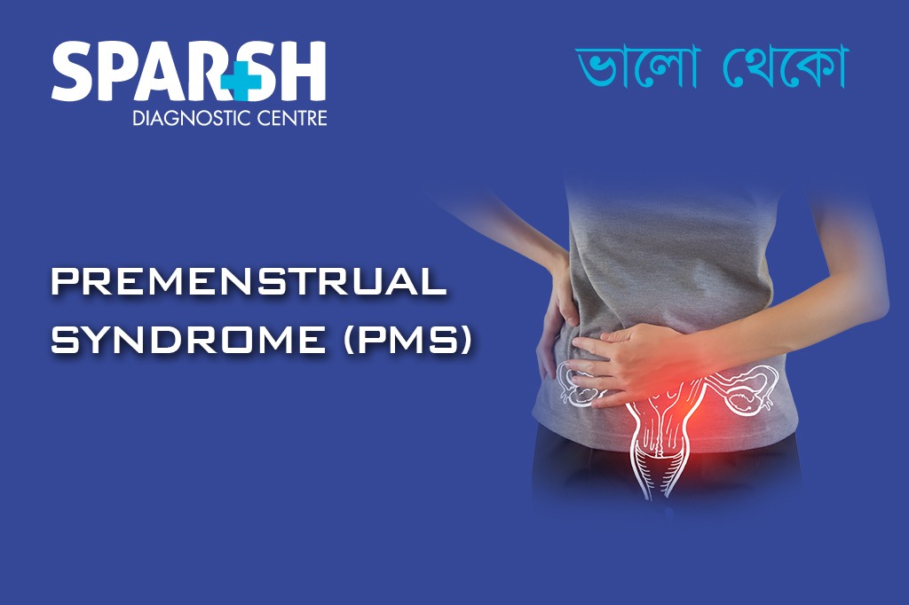 Premenstrual Syndrome PMS CP