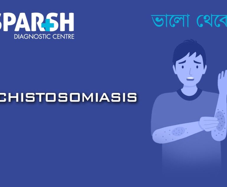 Schistosomiasis
