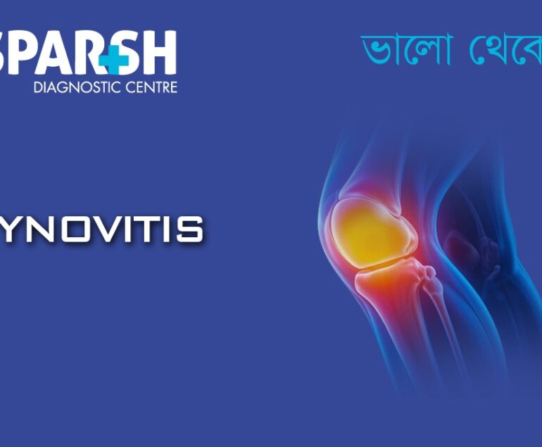 Synovitis