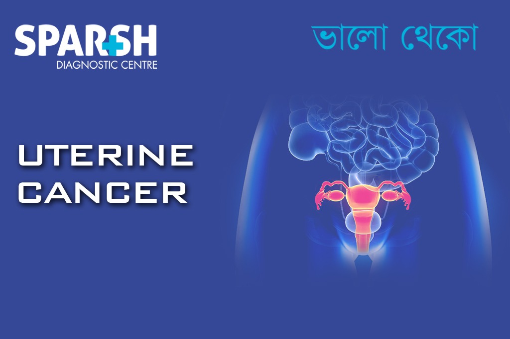 Uterine Cancer CP