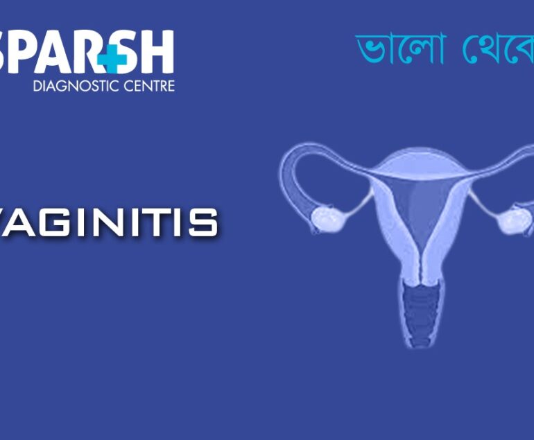 Vaginitis. Best Gynecologist in Kolkata.