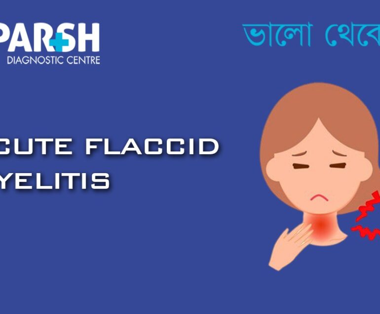 Acute Flaccid Myelitis