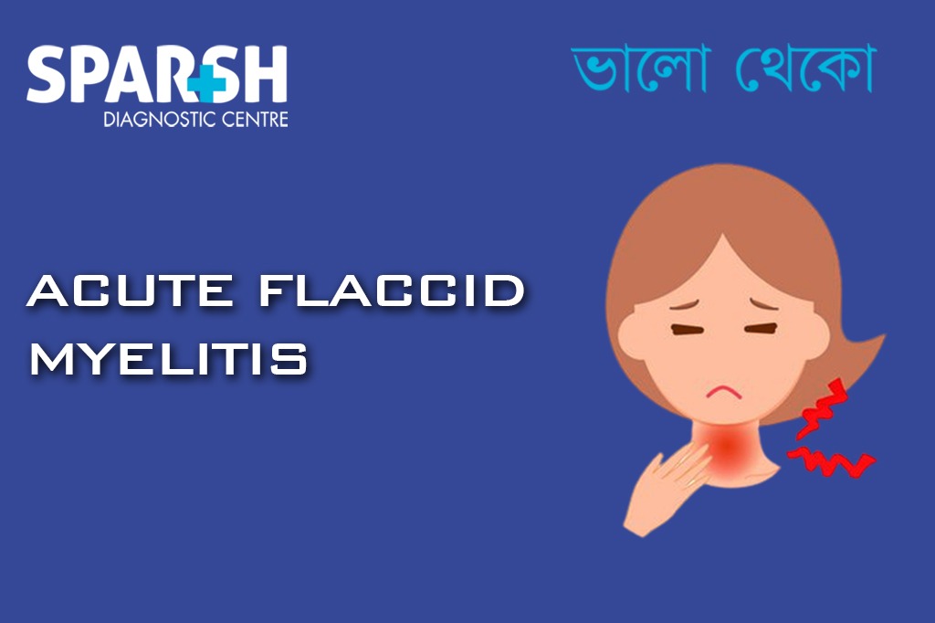 Acute Flaccid Myelitis