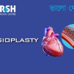 Angioplasty