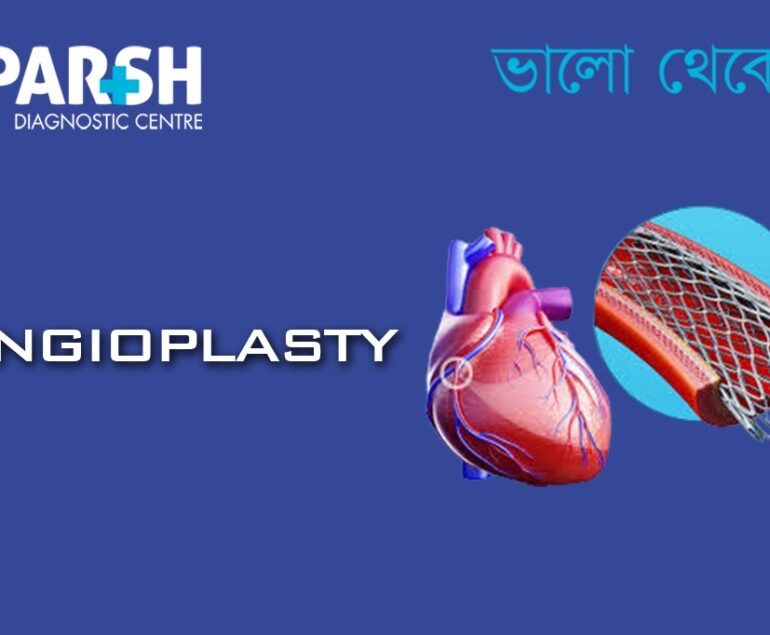 Angioplasty