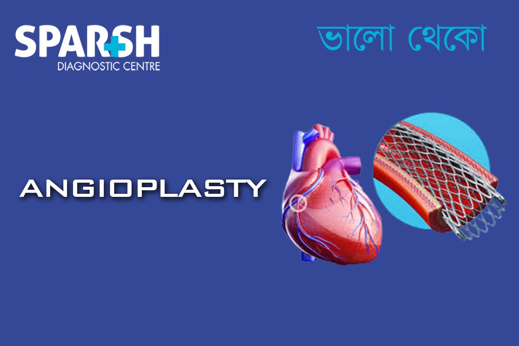 Angioplasty