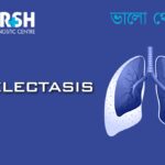 Atelectasis