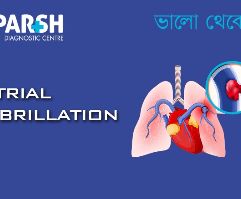 Atrial Fibrillation (AFib)