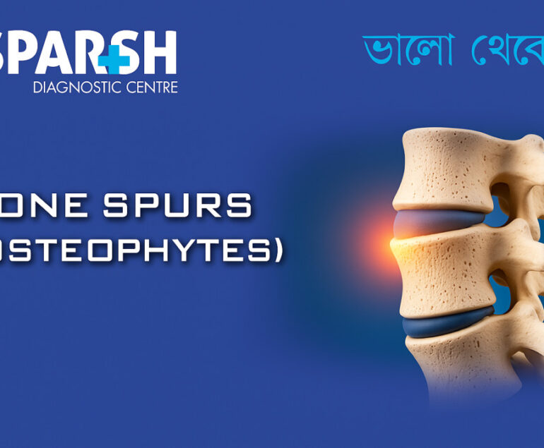 Bone Spurs Osteophytes