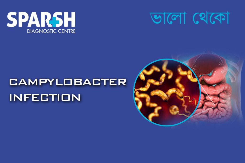 Campylobacter Infection