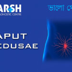 Caput Medusae