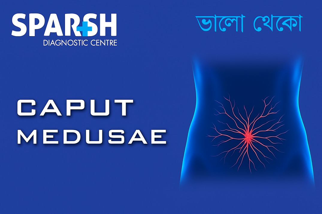 Caput Medusae