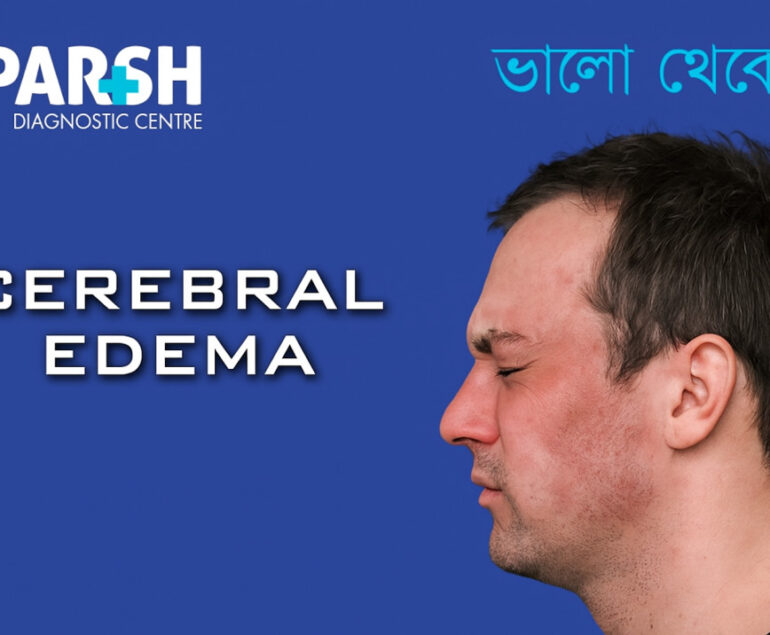 Cerebral Edema