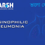 Eosinophilic Pneumonia
