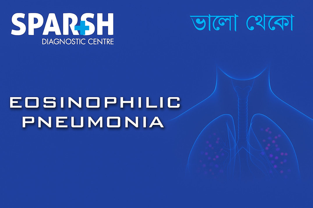 Eosinophilic Pneumonia