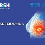 Galactorrhea