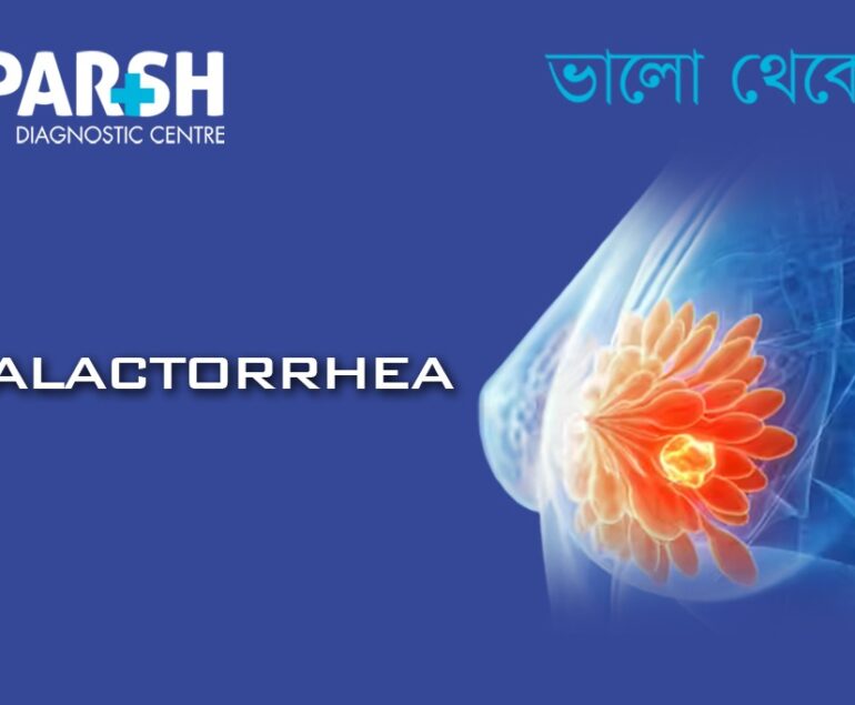 Galactorrhea