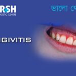 Gingivitis. Best Dentist in Kolkata.