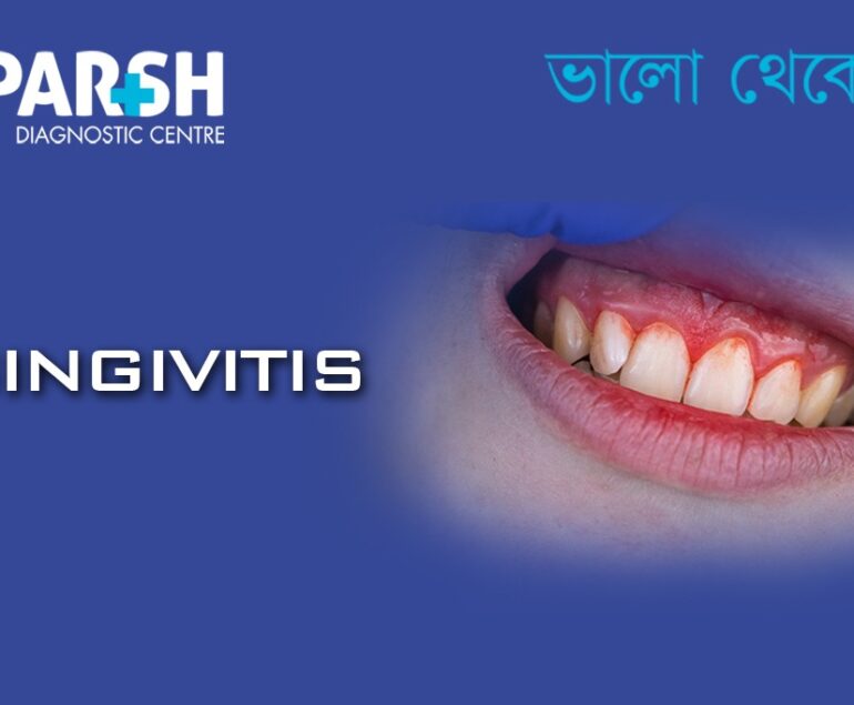 Gingivitis. Best Dentist in Kolkata.