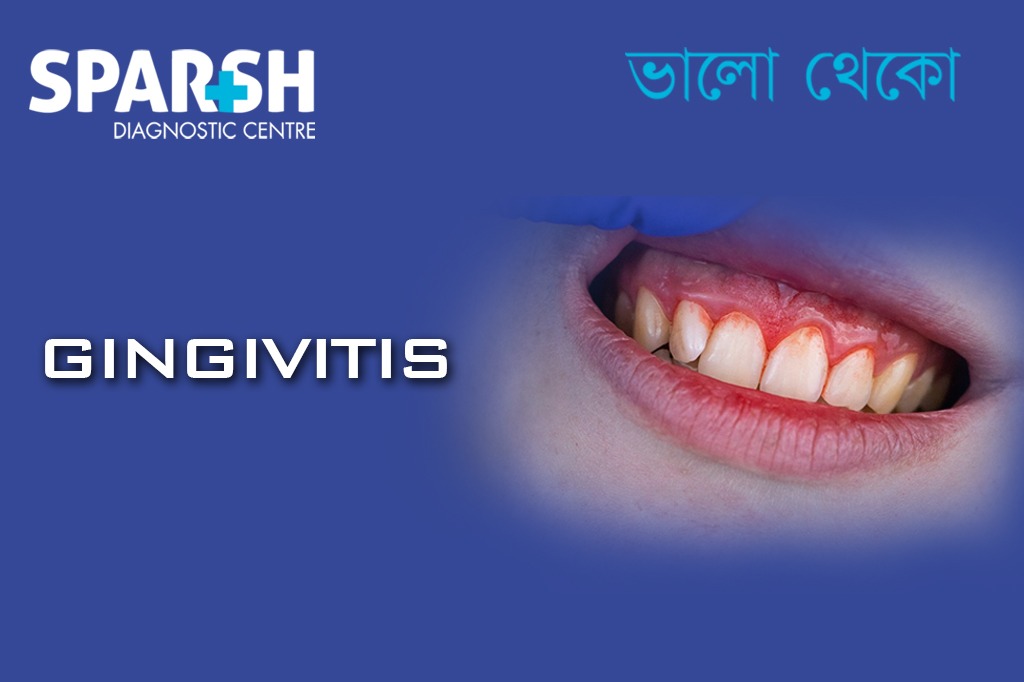 Gingivitis. Best Dentist in Kolkata.