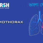 Hemothorax