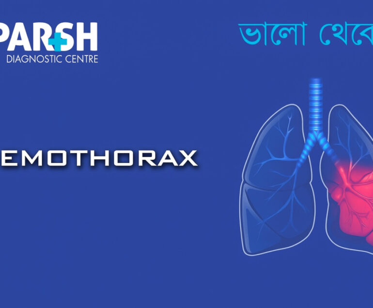 Hemothorax
