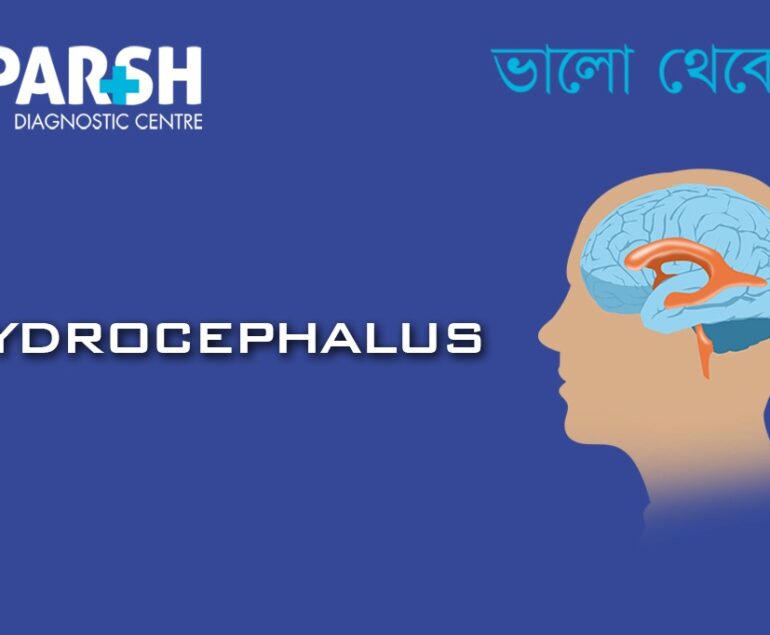 Hydrocephalus CP