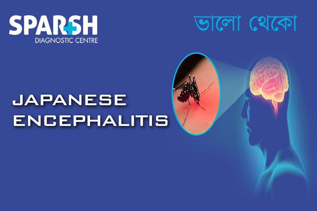 Japanese Encephalitis CP