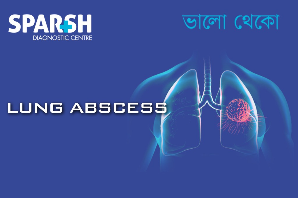 Lung Abscess CP