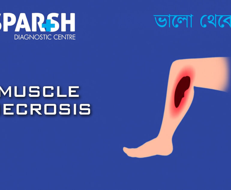 Muscle Necrosis